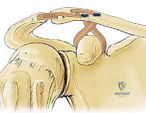 تحليل صور الأشعة في عيادة الدكتور هطيف