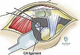 مقارنة النتائج التجميلية قبل وبعد الجراحة