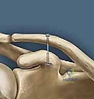Clinical Image