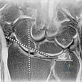 Clinical Image