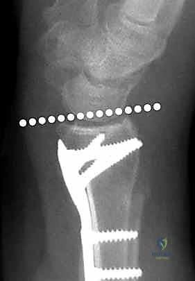 Clinical Image