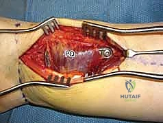 Clinical Image