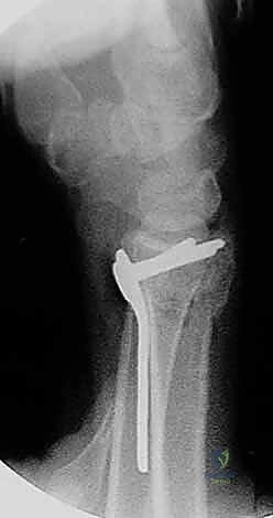 Clinical Image