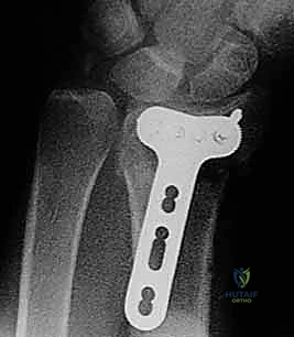 Clinical Image
