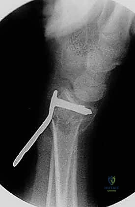 Clinical Image