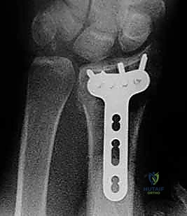 Clinical Image