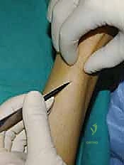 Clinical Image