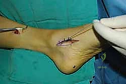 الفحص السريري الدقيق