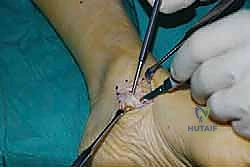 الفحص السريري للقدم في العيادة