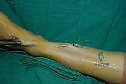 جهاز تخطيط الأعصاب