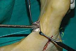 مناقشة الخيارات العلاجية مع المريض