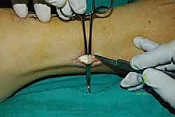 التجهيز داخل غرفة العمليات