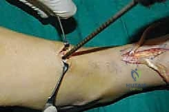 استعداد المريض للعملية