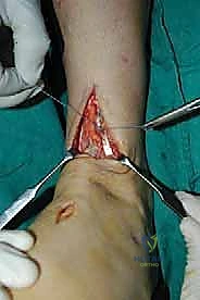 Clinical Image