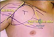 Clinical Image