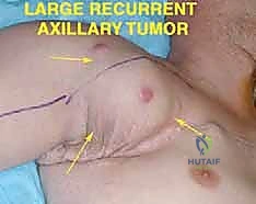 Clinical Image