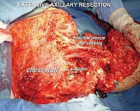 Clinical Image
