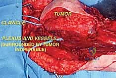 Clinical Image