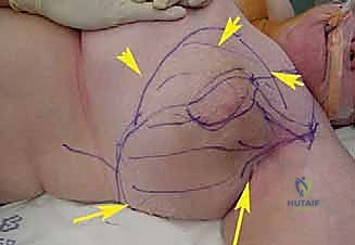 Clinical Image