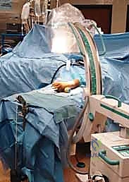 التشريح المعقد للرسغ وتأثير الإصابة