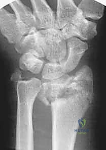 تقييم حالة المريض قبل الجراحة