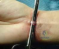Clinical Image