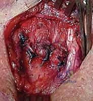 Clinical Image