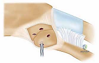 Clinical Image