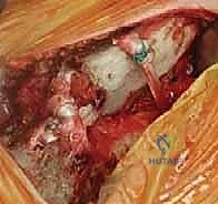 Clinical Image
