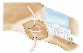 Clinical Image
