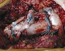 Clinical Image