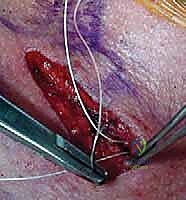 Clinical Image