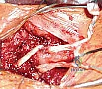 Clinical Image