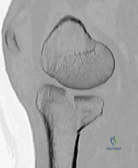 Clinical Image