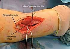 Clinical Image