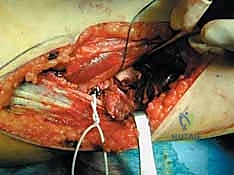 Clinical Image