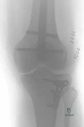 Clinical Image