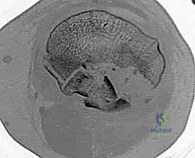 Clinical Image