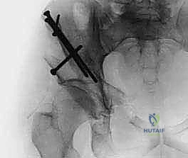 Clinical Image