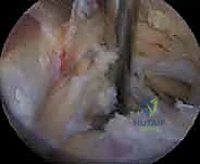 Clinical Image