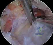 Clinical Image