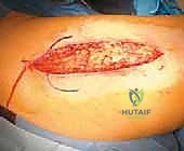 Clinical Image