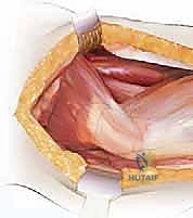 Clinical Image