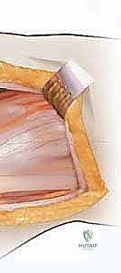 Clinical Image