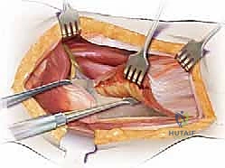 Clinical Image