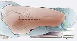 Clinical Image