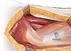 Clinical Image