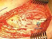 Clinical Image