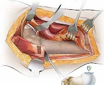 Clinical Image