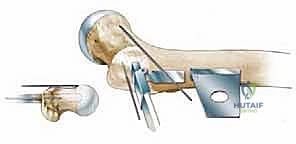 Clinical Image